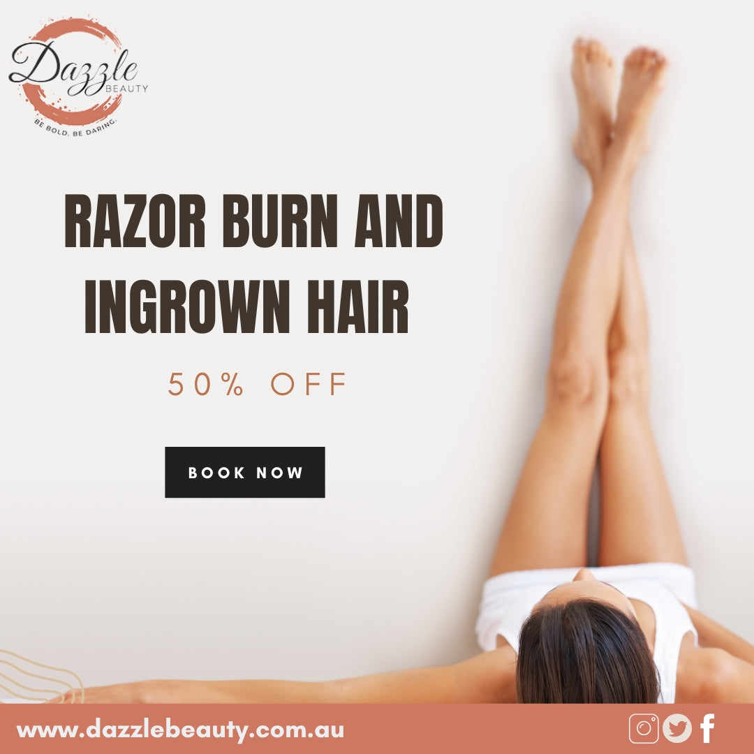 Top Tips for Avoiding Razor Burn and Ingrown Hair !! Top Tips for Avoiding Razor Burn and Ingrown Hair !!